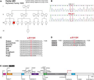 Altered Gene-Regulatory Function of KDM5C by a Novel Mutation Associated With Autism and Intellectual Disability